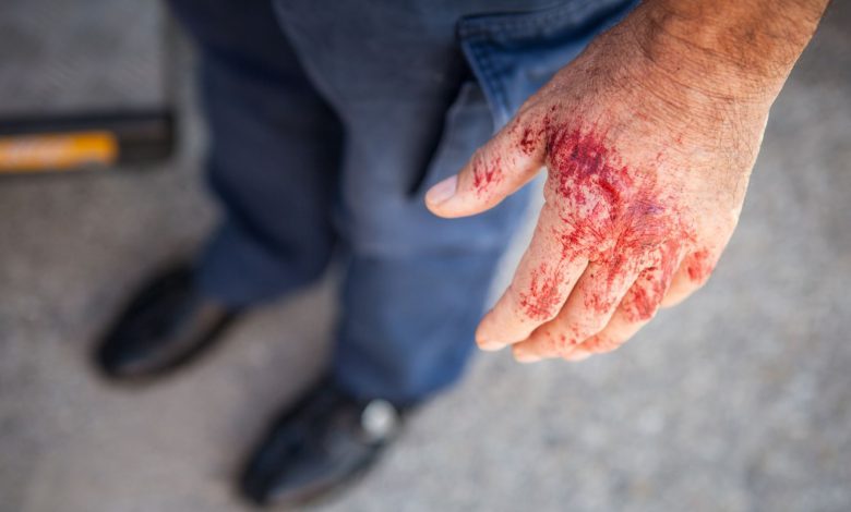 شجار دموي بين شاب وشابة أتراك في فيينا يتصاعد إلى اعتداء على الشرطة وإصابة ضابطين