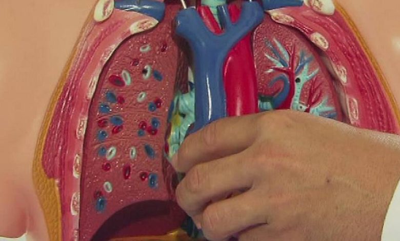 خطأ طبي جديد في شتايرمارك.. استئصال رئة سليمة لامرأة بعد تشخيص خاطئ بالسرطان