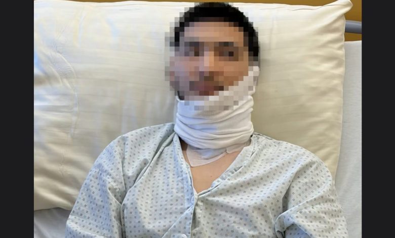 رواية رعب يرويها الأفغاني “مهدي” بعد جراحة خطيرة في الرقبة بعد حادثة الطعن في النمسا العليا على يد كرواتي رواية رعب يرويها الأفغاني “مهدي” بعد جراحة خطيرة في الرقبة بعد حادثة الطعن في النمسا العليا على يد كرواتي