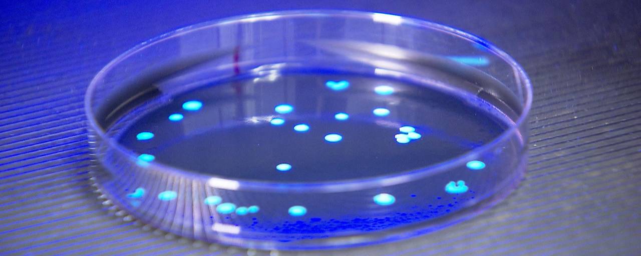 السلطات الصحية في النمسا تفحص مبنى سكنياً بعد وفاة امرأة بكتيريا Legionella في Amstetten السلطات الصحية في النمسا تفحص مبنى سكنياً بعد وفاة امرأة بكتيريا Legionella في Amstetten